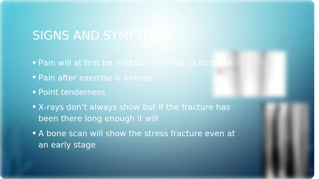 Stress Fracture of Tibia_dtvrvqh8yqs_page4