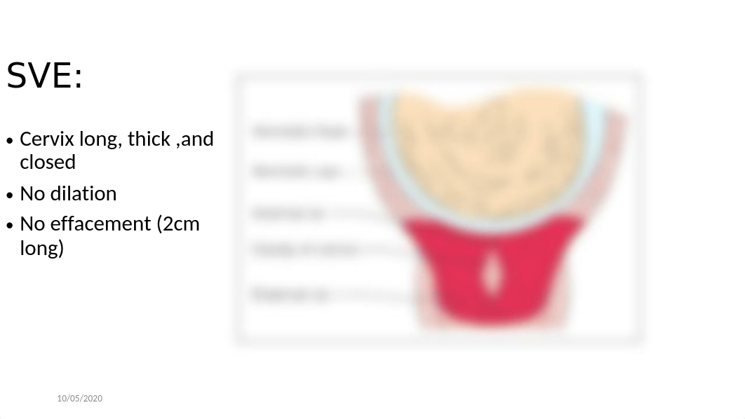 Assessment of the Labor Patient 9.20 - Copy.pptx_dtz7a61kl54_page5