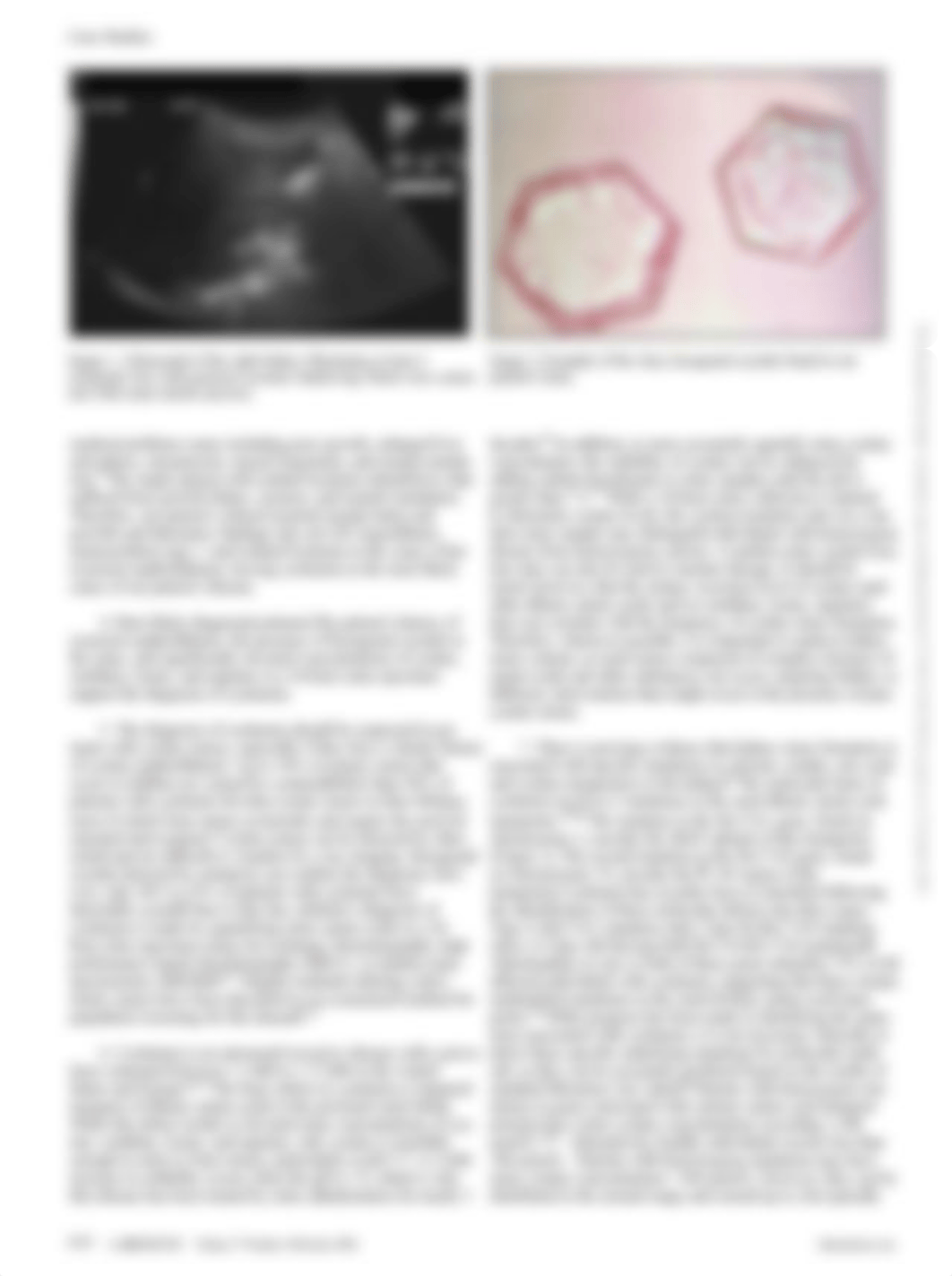 Kidney Stones Case Study.pdf_du2bz6nluyd_page2