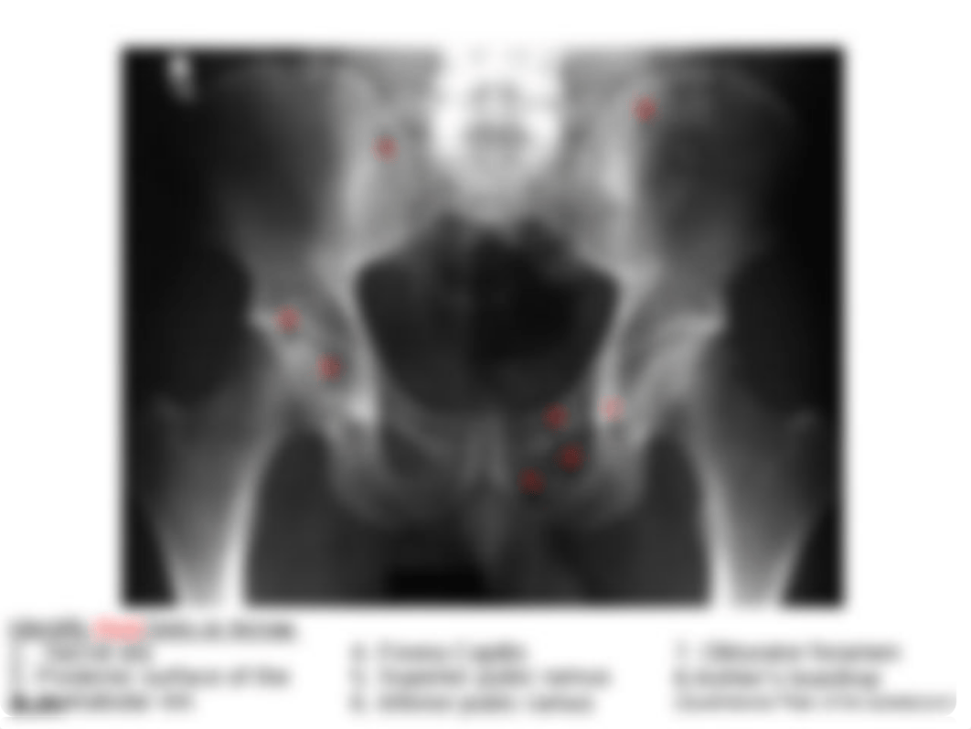 RADD 1611 A-P Pelvis_du3dwmtfsi0_page3