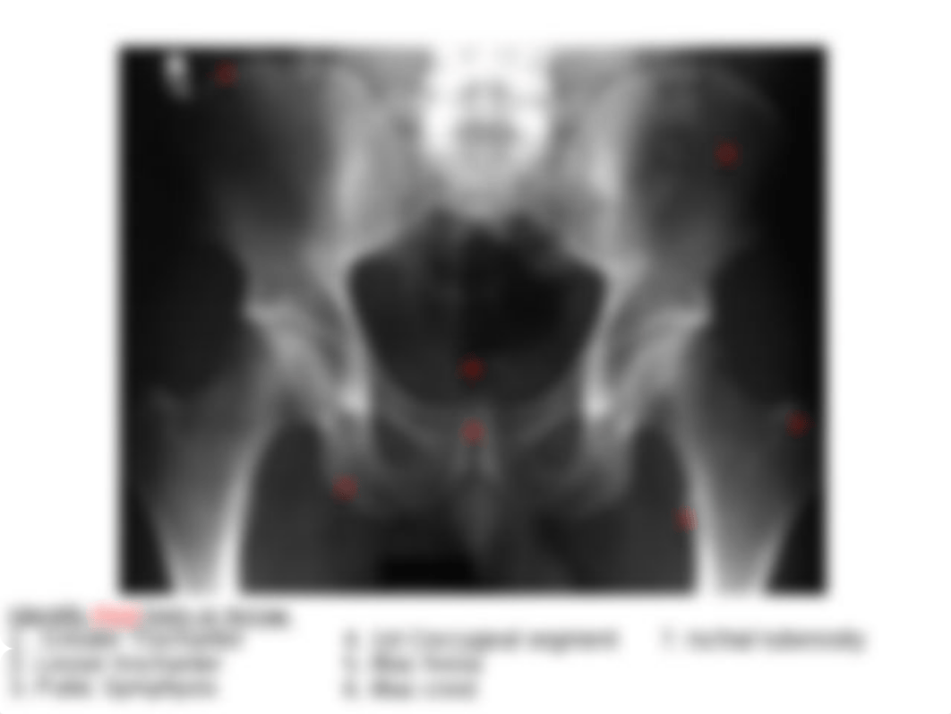 RADD 1611 A-P Pelvis_du3dwmtfsi0_page4