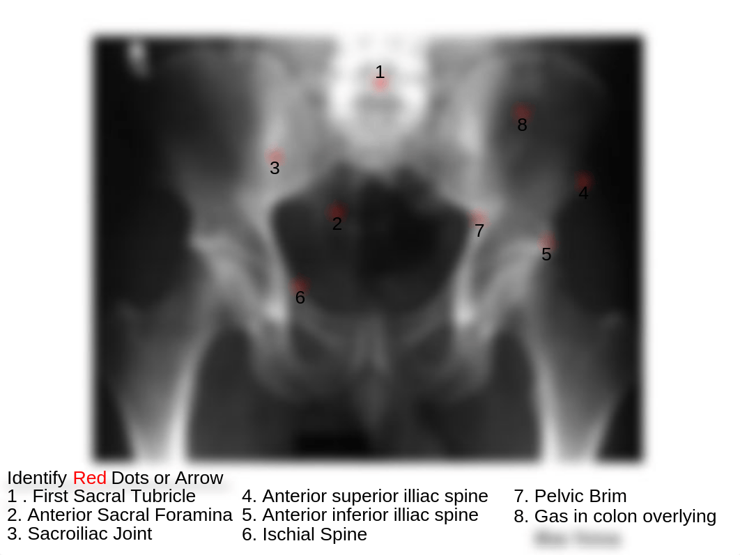 RADD 1611 A-P Pelvis_du3dwmtfsi0_page2