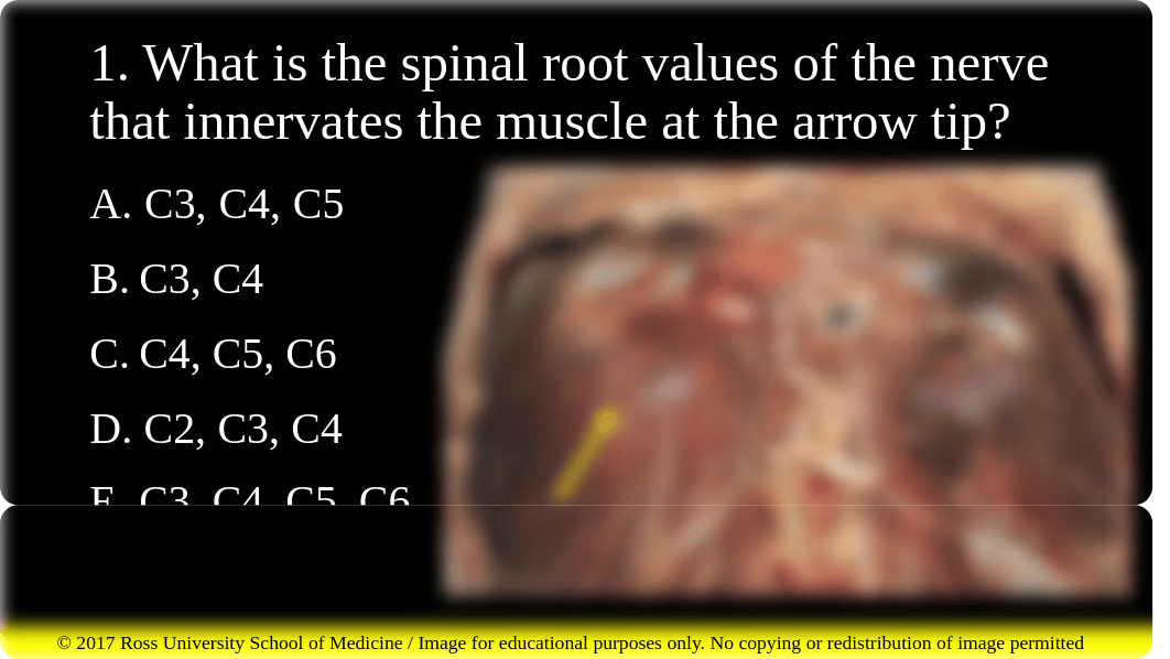 Kidney, Diaphragm and Posterior Abdominal Wall.pdf_du3iiayc9la_page2