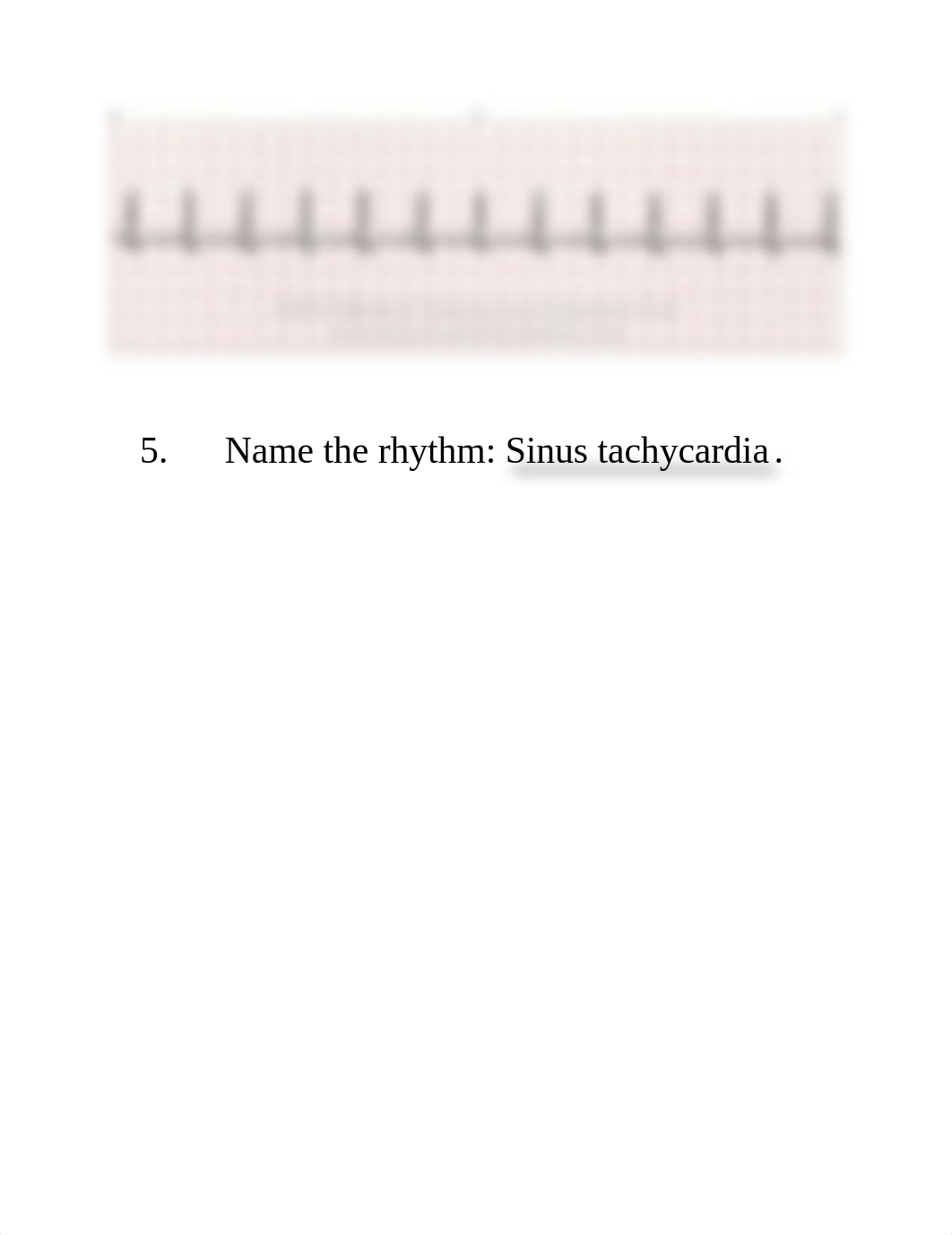 EKG Quiz.docx_du8b4txj10k_page5