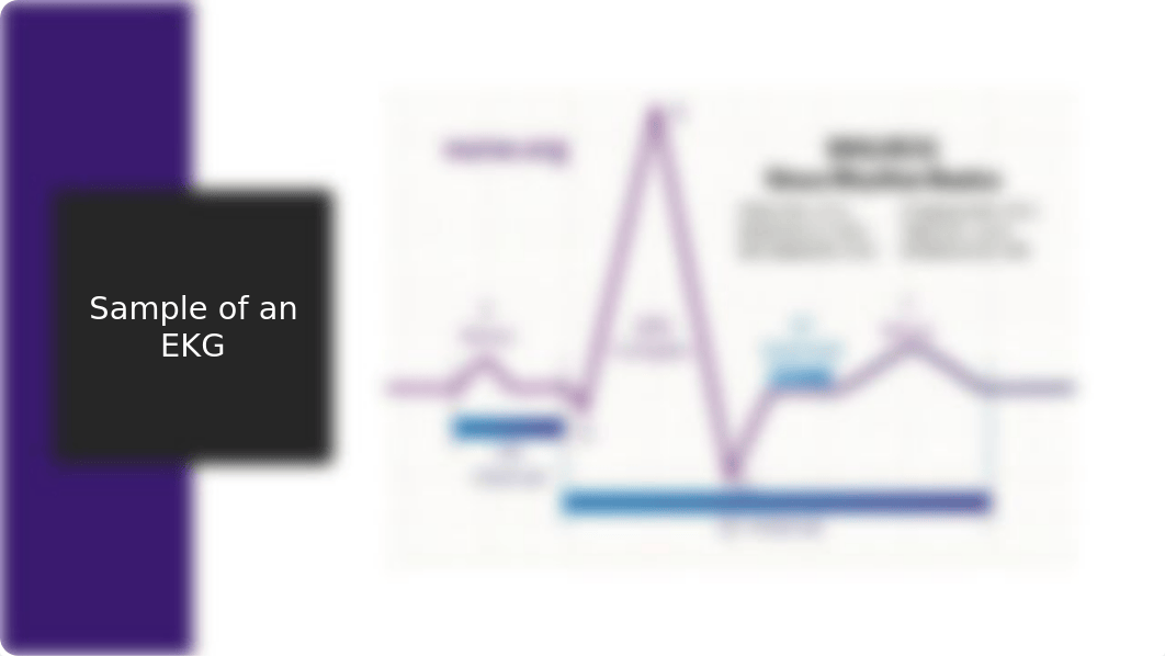 EKG READING.pptx_ductvpdmikb_page4