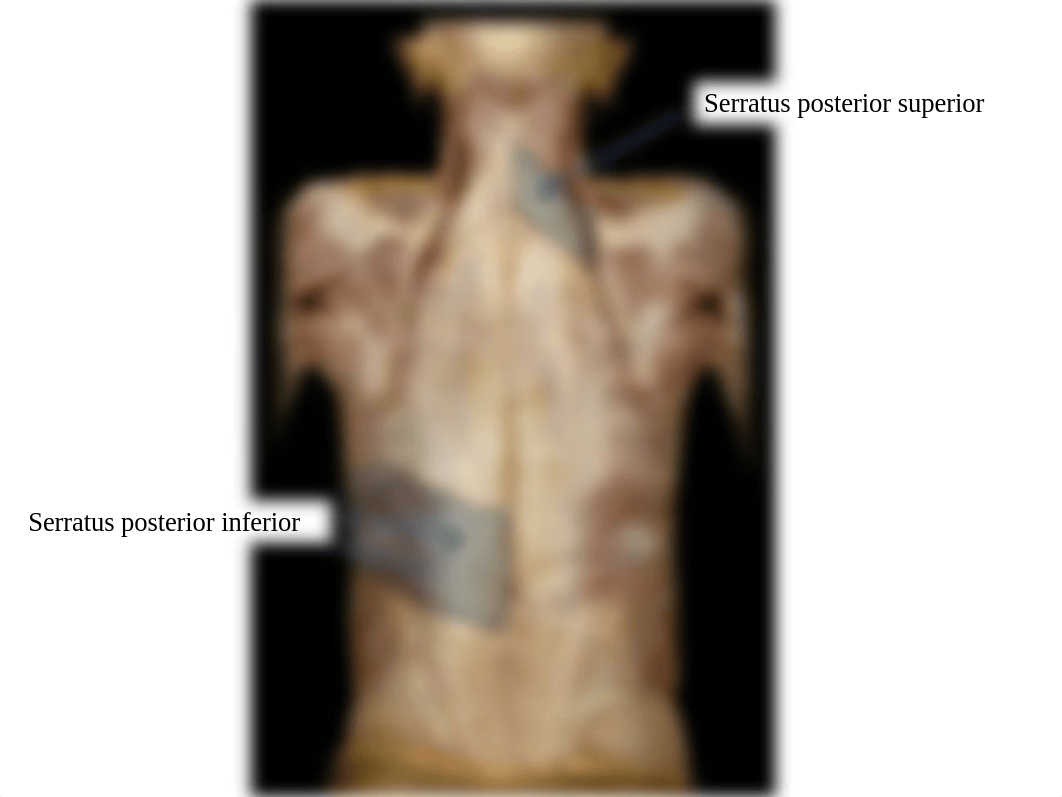 Exam 1 Copy of IDs - vertebral Column - back muscles_dunv9k92upc_page4