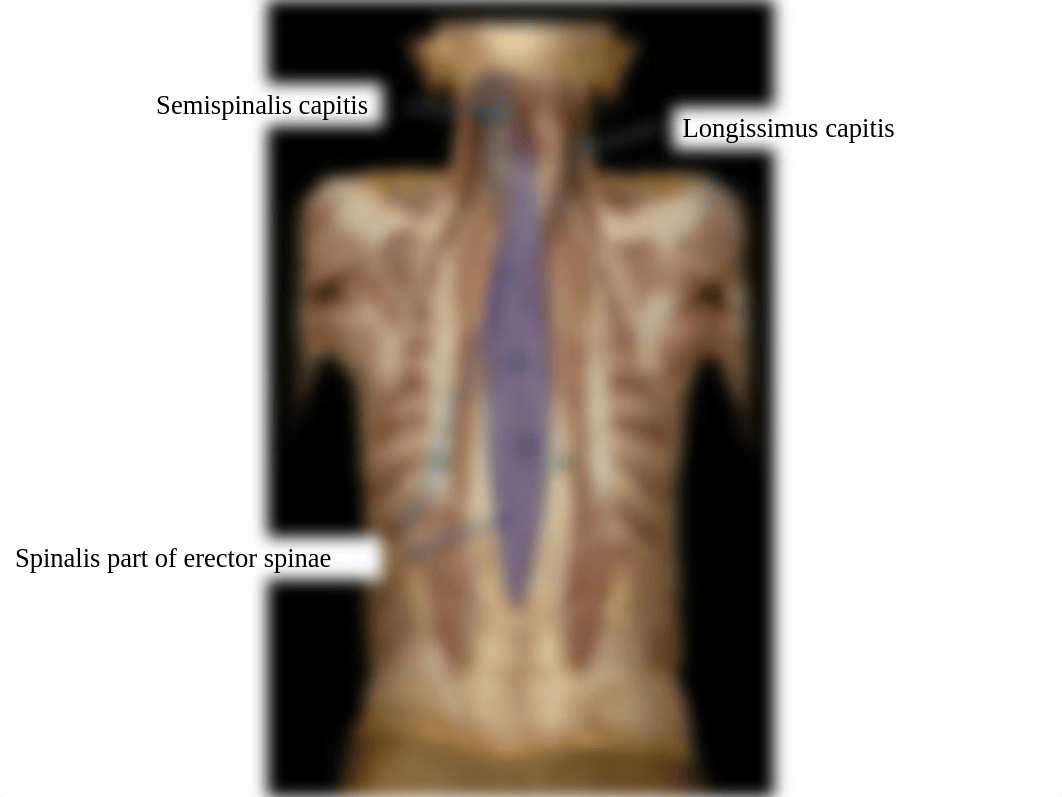 Exam 1 Copy of IDs - vertebral Column - back muscles_dunv9k92upc_page5