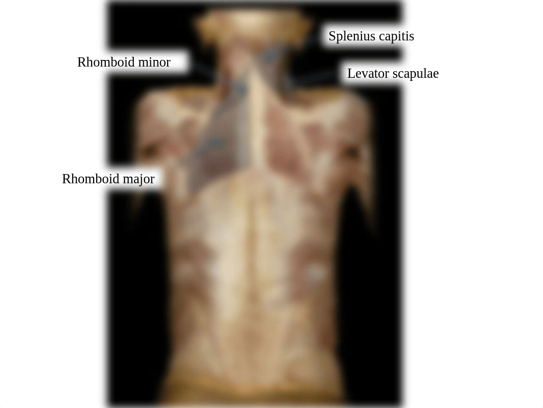 Exam 1 Copy of IDs - vertebral Column - back muscles_dunv9k92upc_page3