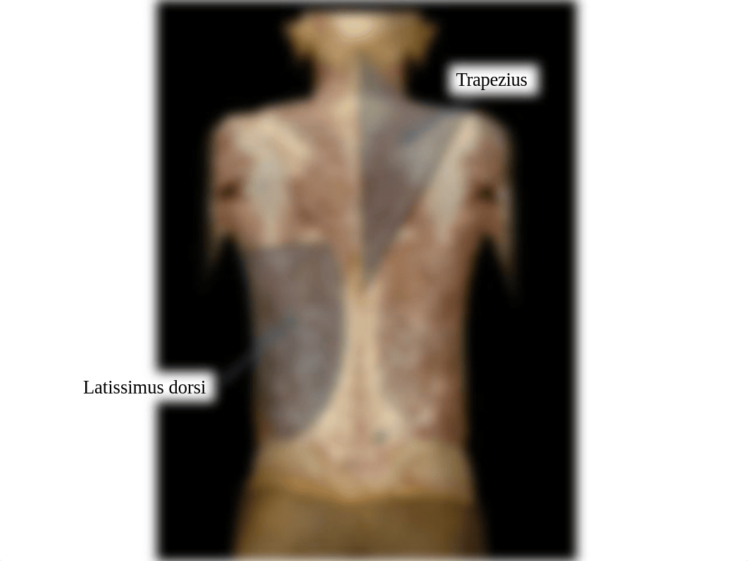 Exam 1 Copy of IDs - vertebral Column - back muscles_dunv9k92upc_page2