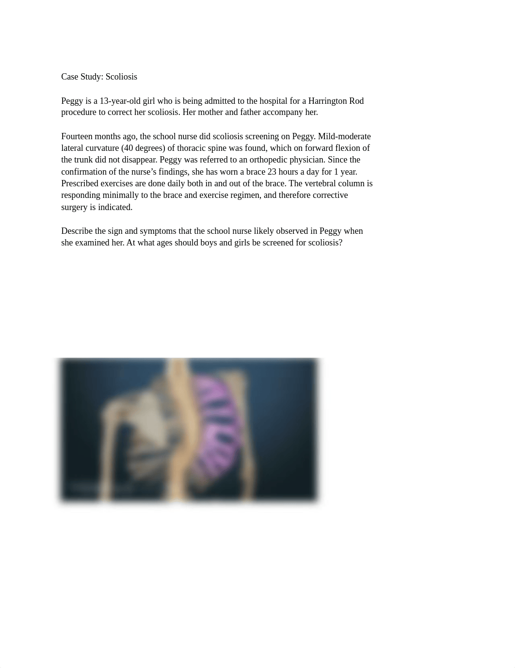 NURS 236 Scoliosis Case Study.docx_dupt3sq5iwc_page1