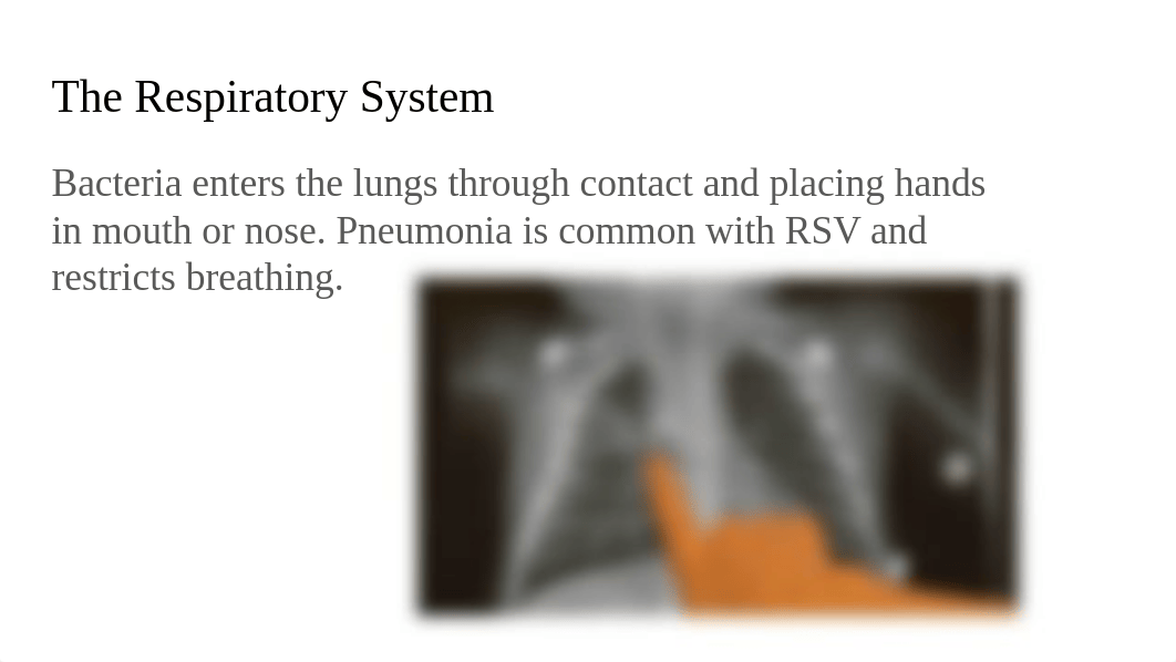 Respiratory Syncytial Virus (RSV) severe case_duuxlejjtcj_page5