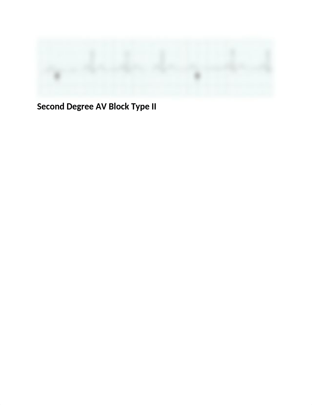 cardiac ryhthms-strips (1)_answers.docx_duwo3bj48s9_page4