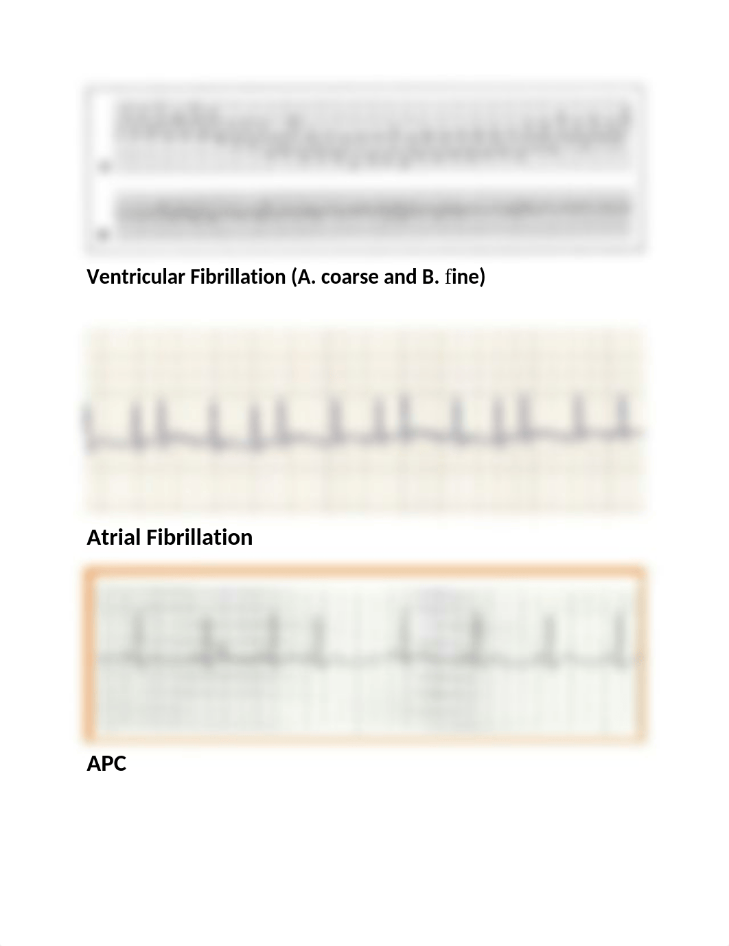 cardiac ryhthms-strips (1)_answers.docx_duwo3bj48s9_page3