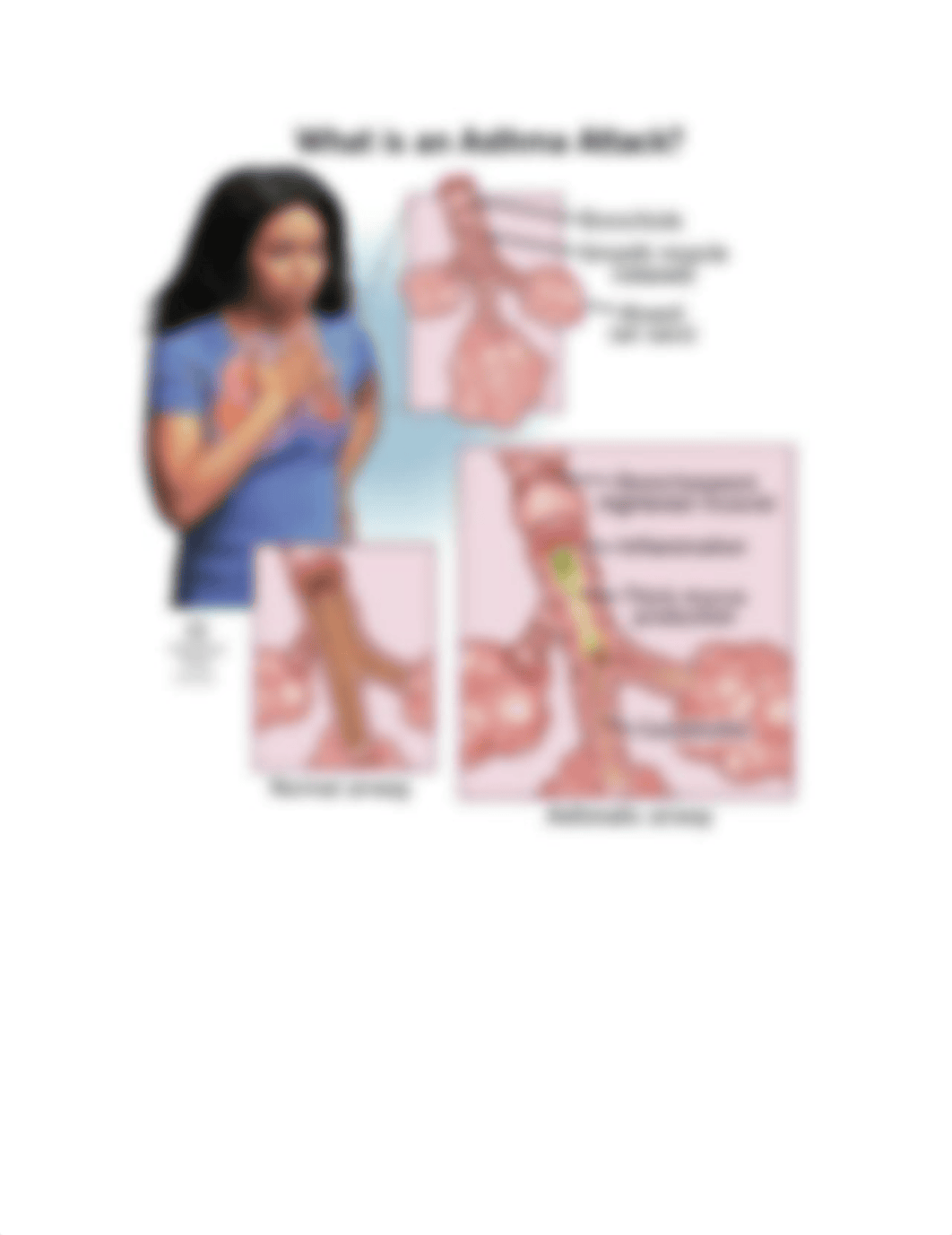 What are the signs of Asthma I will inform you on a few sign of Asthma.docx_dv0r6zie5wa_page2