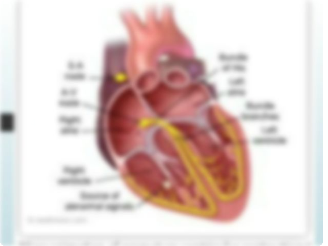 EKG's - A Basic Understanding PA college lecture (1).pptx_dv63b91peer_page4