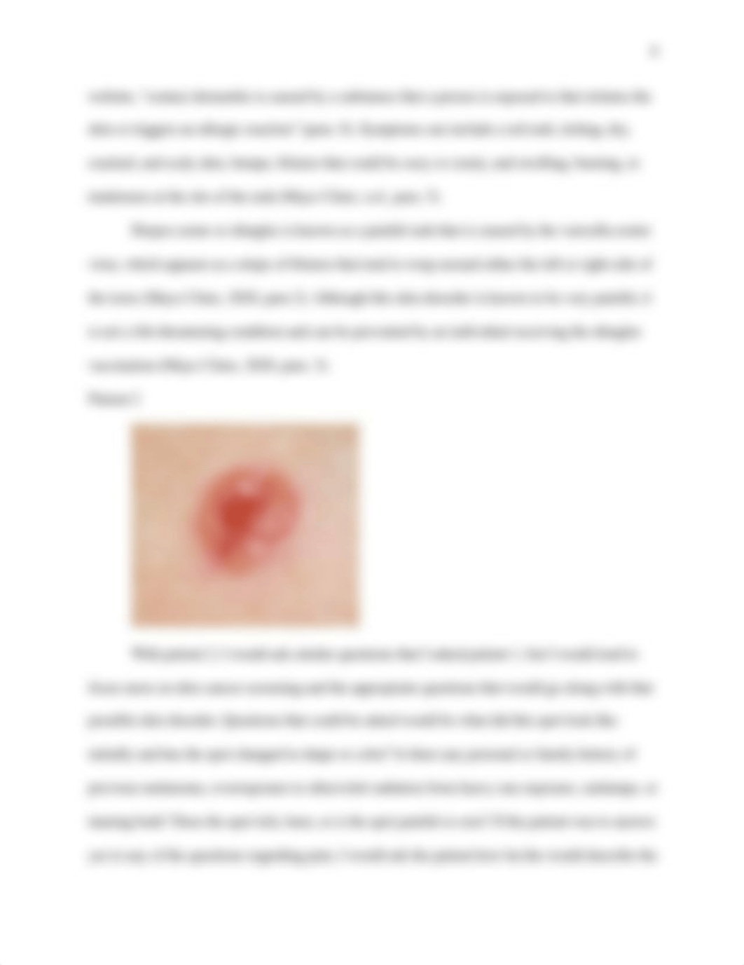 NUR602_Smith_A_Dermatology2.docx_dvagpff6ta5_page4