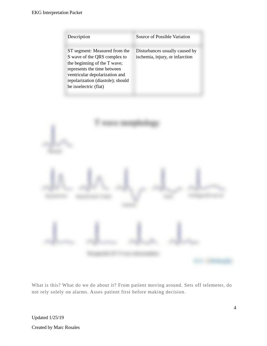 EKG.docx_dvazi93x6y7_page4