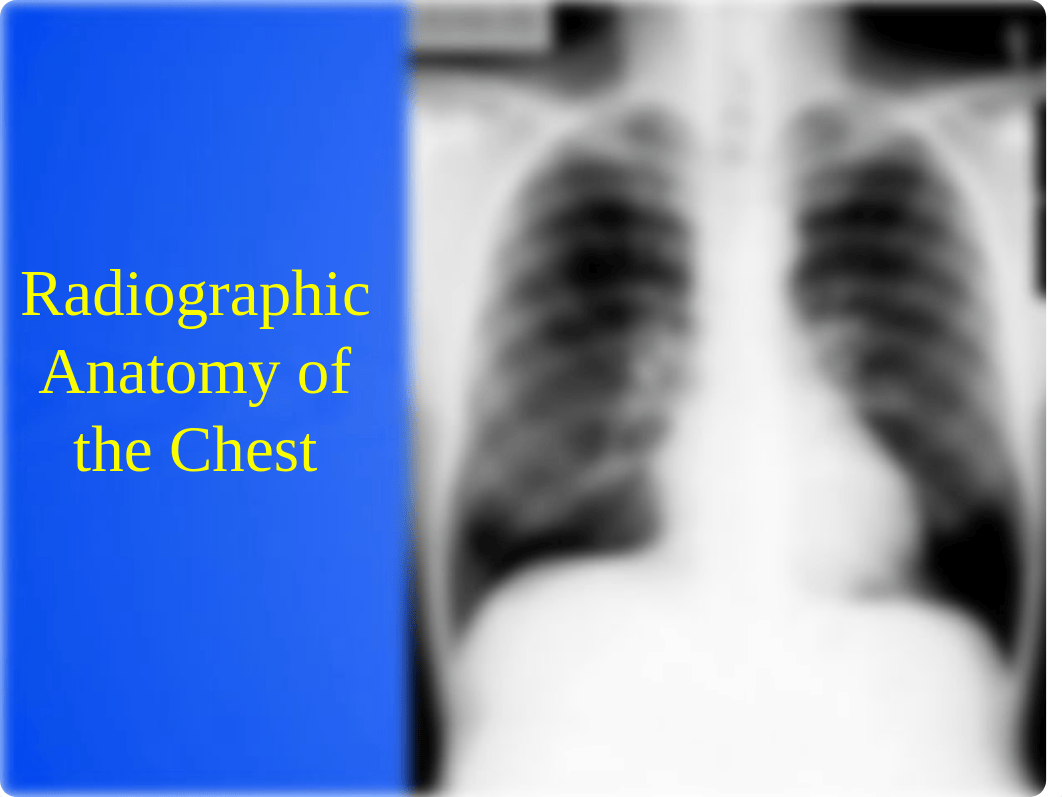 7 Chest ppt(1).pptx_dvbp6ruqgkb_page2