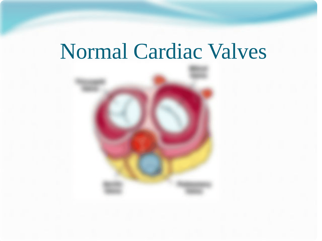 cardiac valve disorders powerpoint_dvcl7k8wcsy_page5