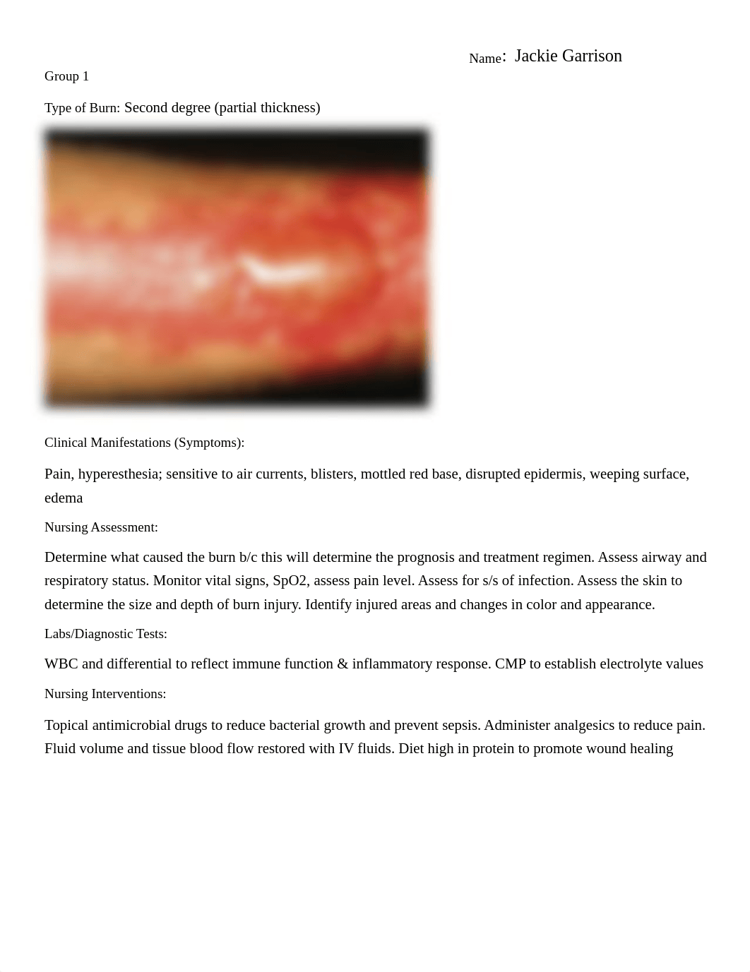 Care of Patients with Burns-Group Activity (Adult 2).pdf_dvefwqko1cm_page1