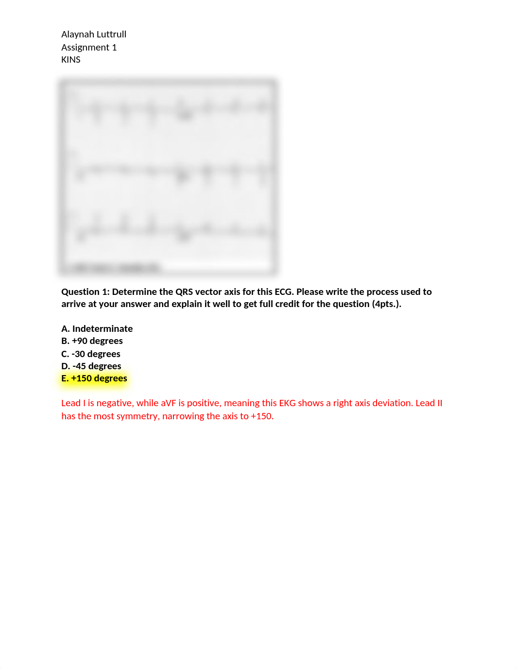 EKG Assignment 1 Resubmission .docx_dvfa0dwjla6_page1