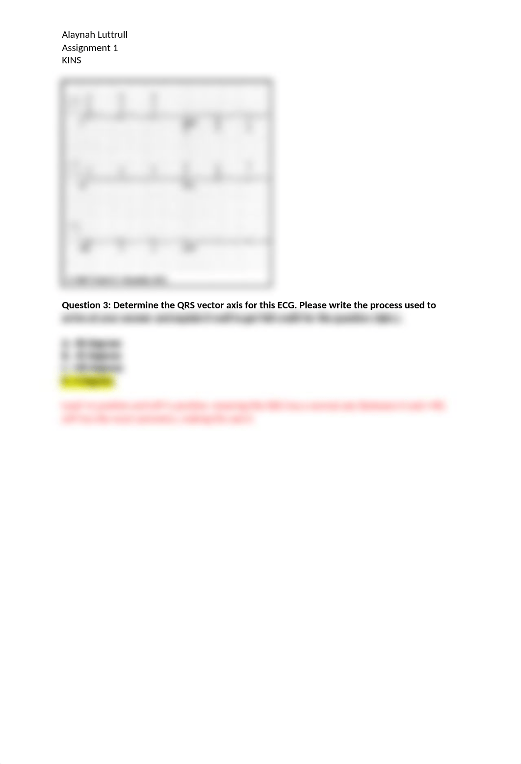 EKG Assignment 1 Resubmission .docx_dvfa0dwjla6_page3