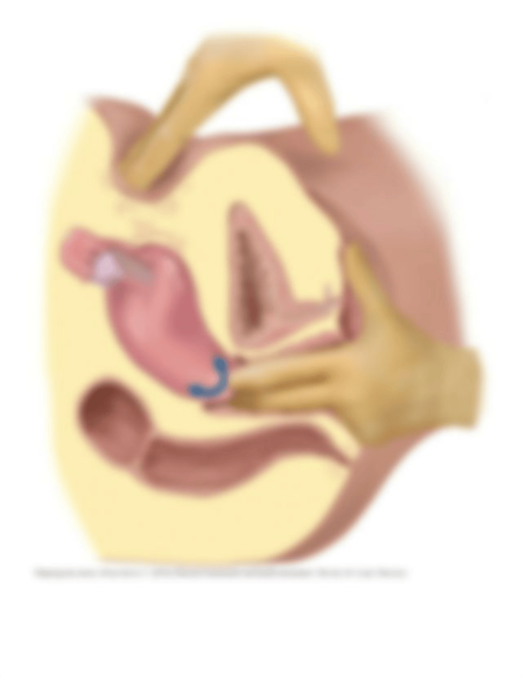 Pelvic Examination 2.pdf_dvpqjd4tcvk_page4