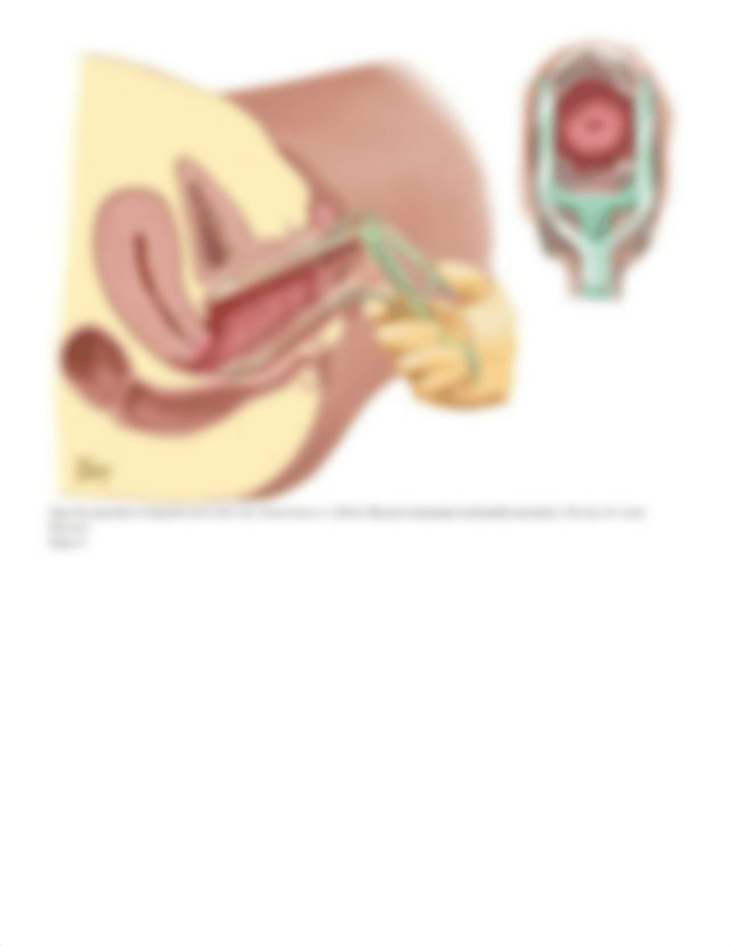 Pelvic Examination 2.pdf_dvpqjd4tcvk_page3