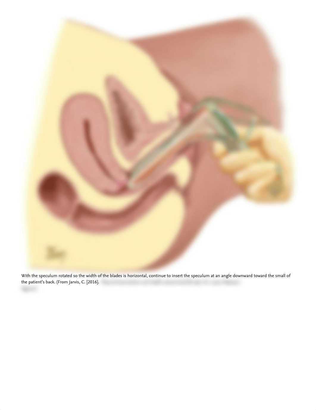 Pelvic Examination 2.pdf_dvpqjd4tcvk_page2