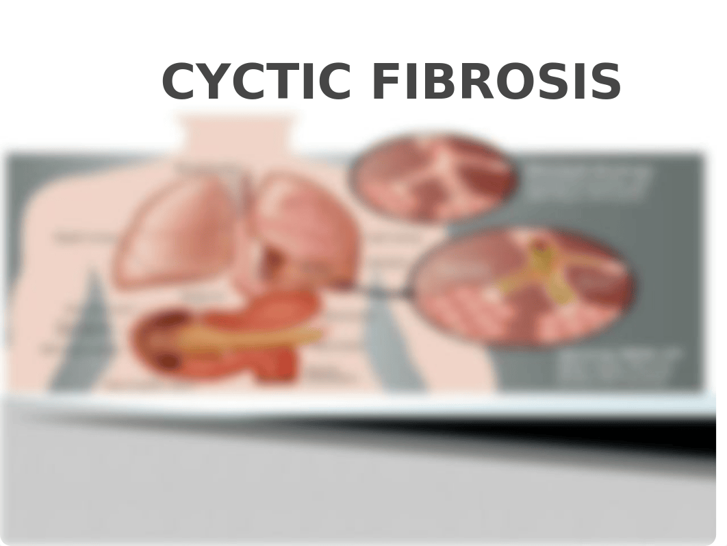 GROUP 2 CYCTIC FIBROSIS.pptx_dvwumg9zrt9_page3