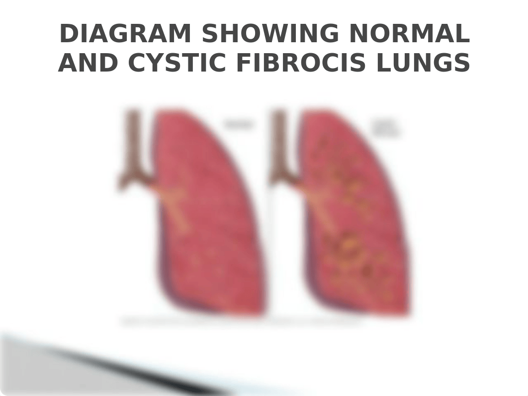 GROUP 2 CYCTIC FIBROSIS.pptx_dvwumg9zrt9_page5