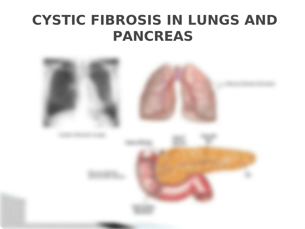 GROUP 2 CYCTIC FIBROSIS.pptx_dvwumg9zrt9_page4