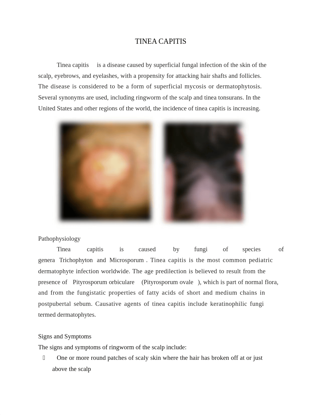 Tinea capitis.docx_dvxj2dvmyu8_page2