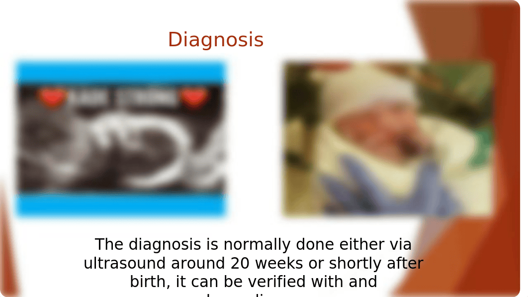 HLHS- Hypoplastic Left Heart Syndrome (power point).pptx_dvyf4xyt0ma_page3