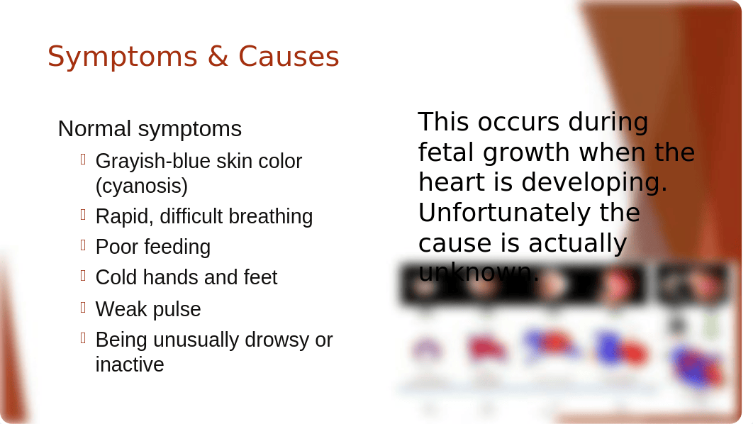 HLHS- Hypoplastic Left Heart Syndrome (power point).pptx_dvyf4xyt0ma_page4