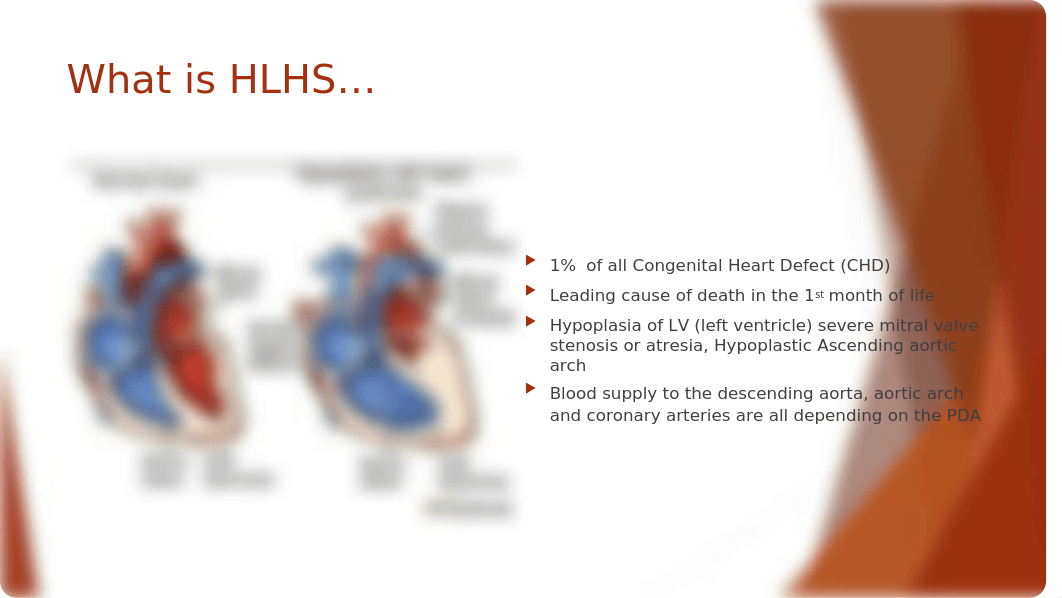 HLHS- Hypoplastic Left Heart Syndrome (power point).pptx_dvyf4xyt0ma_page2