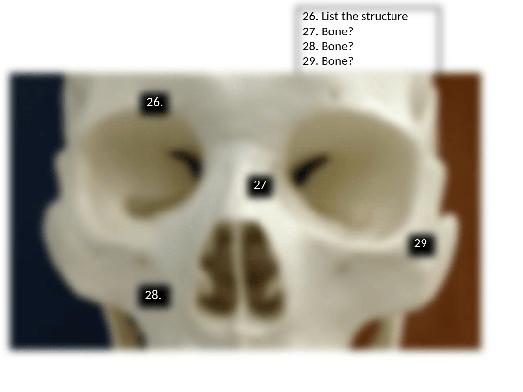 Bone Exam Lab.pptx_dvzfrueuln0_page2