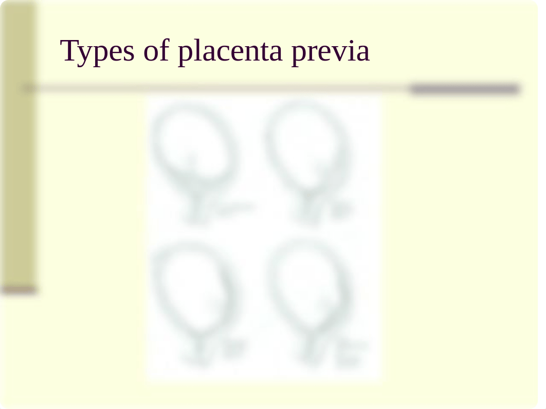 Placenta_Previa_Abruptio.ppt_dw09gr5kzjq_page3