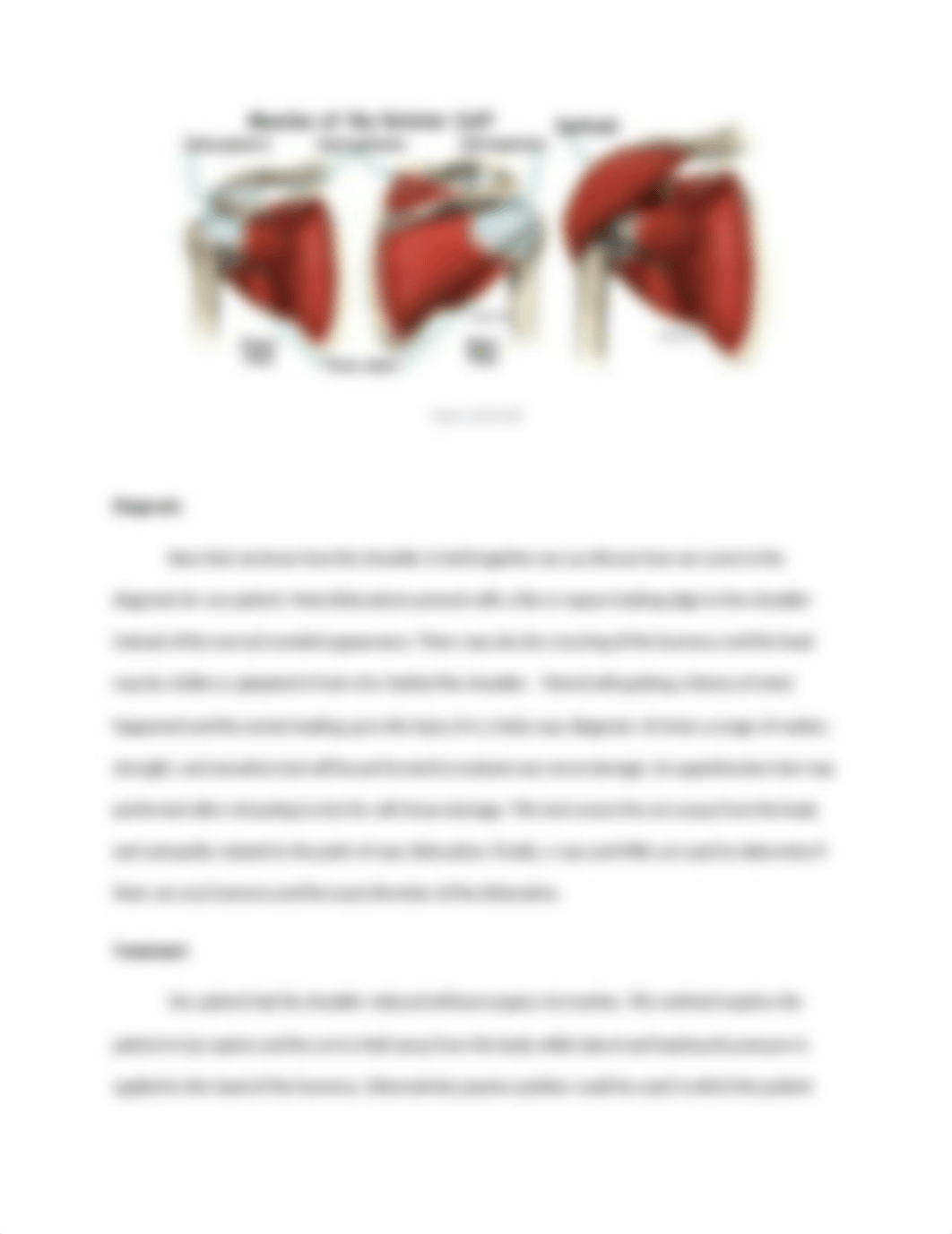 Dislocated Shoulder Care and Management - Lab 8.docx_dw0lrbbln8p_page4