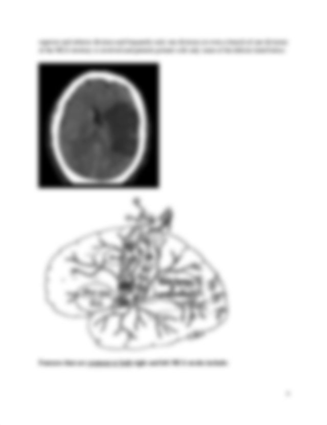 3656697_56666614_5.0Cerebrovascular_Disease_sophomore_neuroscience_2016.docx_dw0xbecjr0l_page4