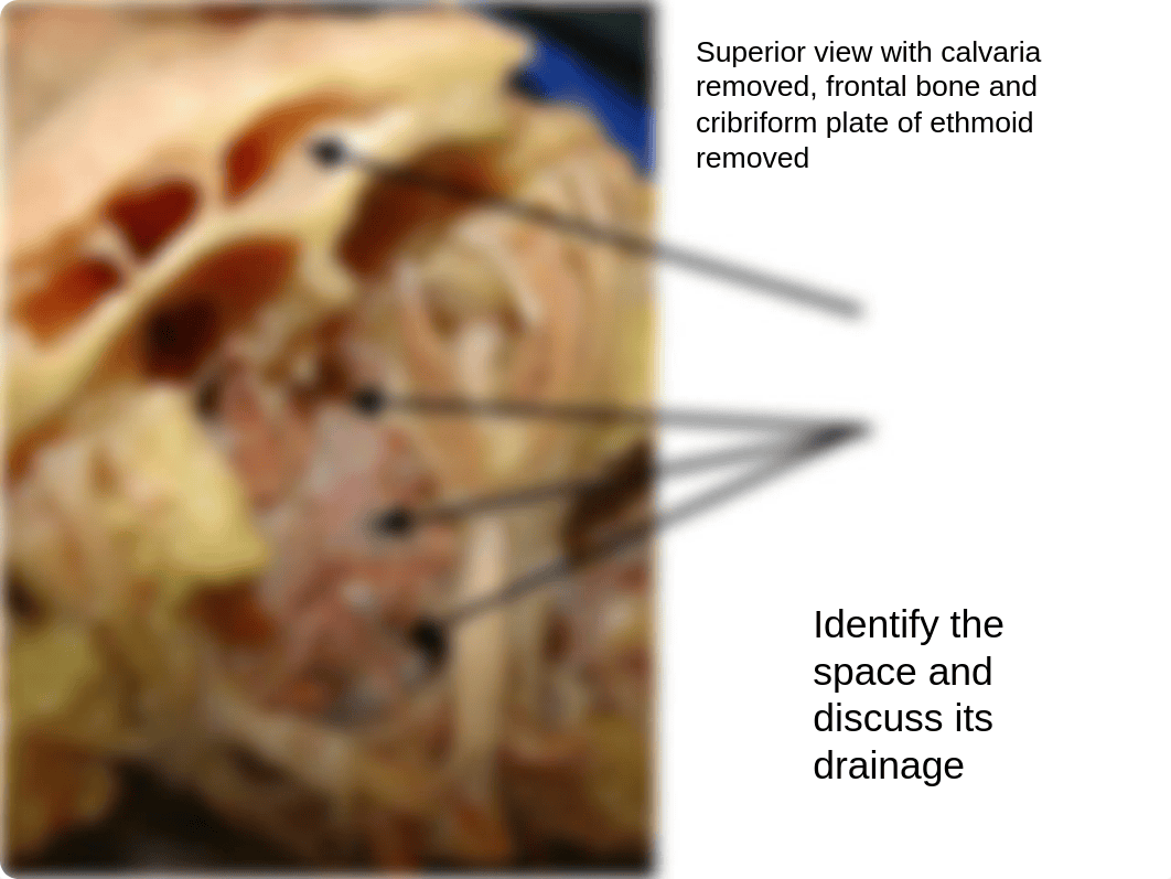 Lab Nasal Cavity and Paranasal Sinuses_dw3s7i7zjd9_page2