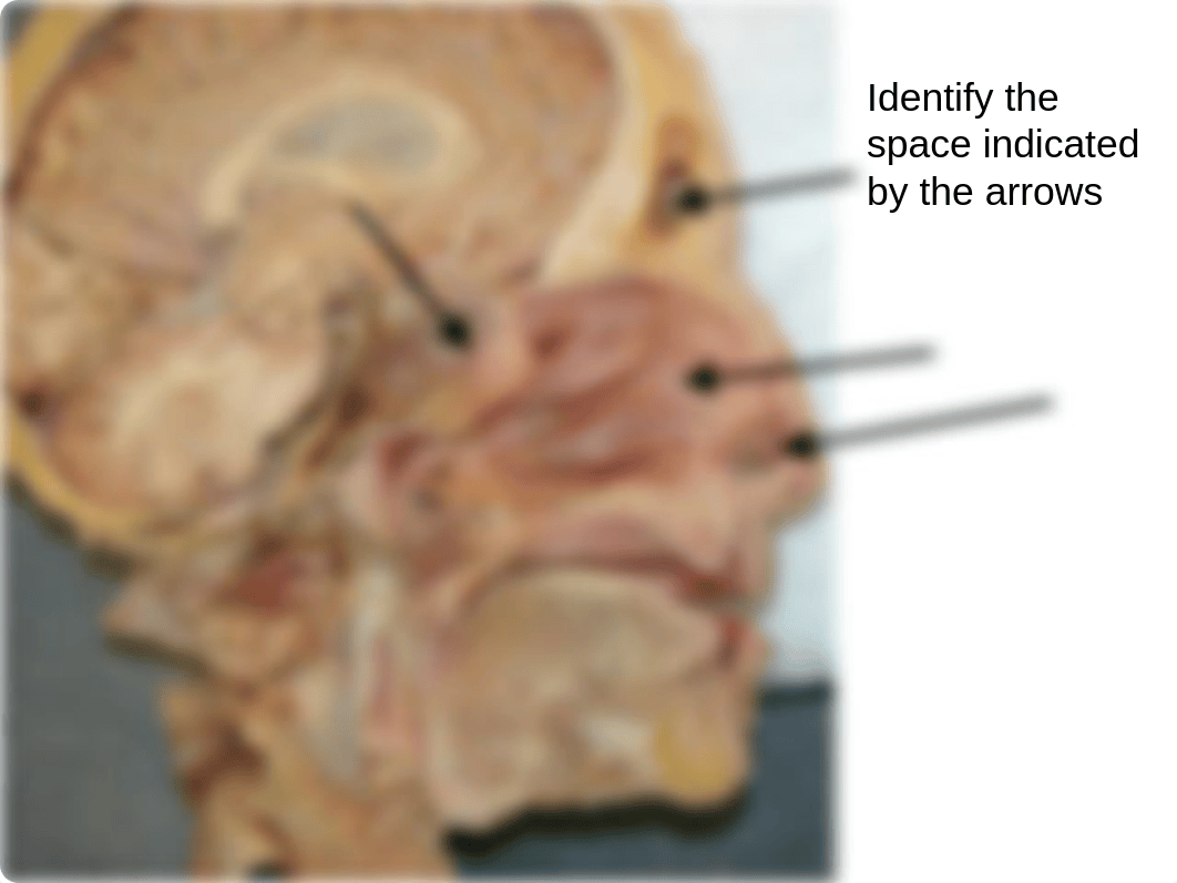 Lab Nasal Cavity and Paranasal Sinuses_dw3s7i7zjd9_page3