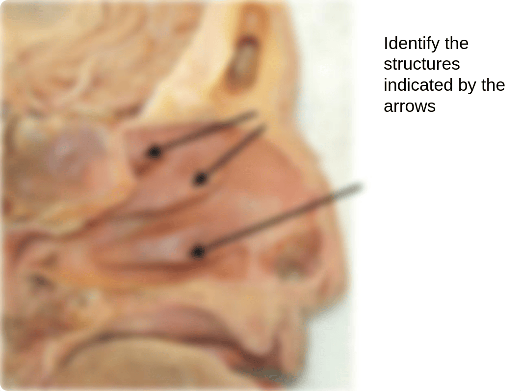 Lab Nasal Cavity and Paranasal Sinuses_dw3s7i7zjd9_page4