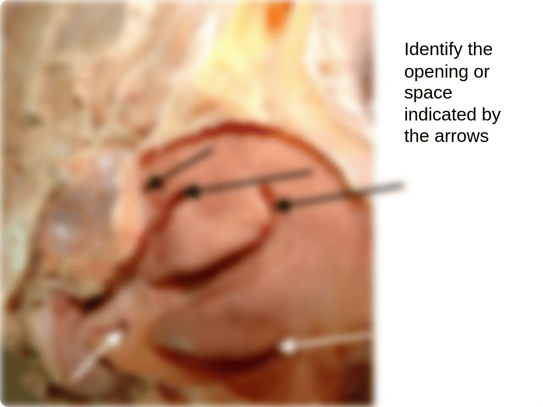 Lab Nasal Cavity and Paranasal Sinuses_dw3s7i7zjd9_page5