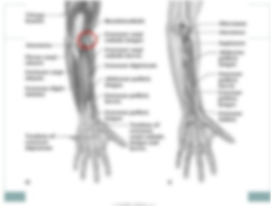 Elbow, Wrist, Hand NTP F12.ppt_dw5tnd4x0m7_page5