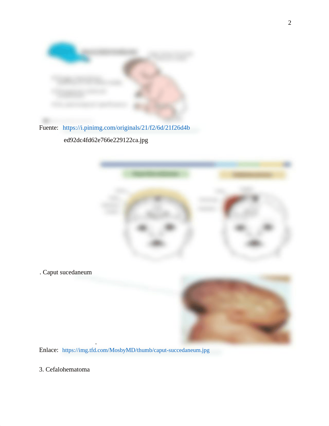 TAREA #5 NURS 2142 PRACTICA MATERNO NEONATAL RECIEN NACIDO- Rev 2020 MYG.docx_dw62askhm5q_page2