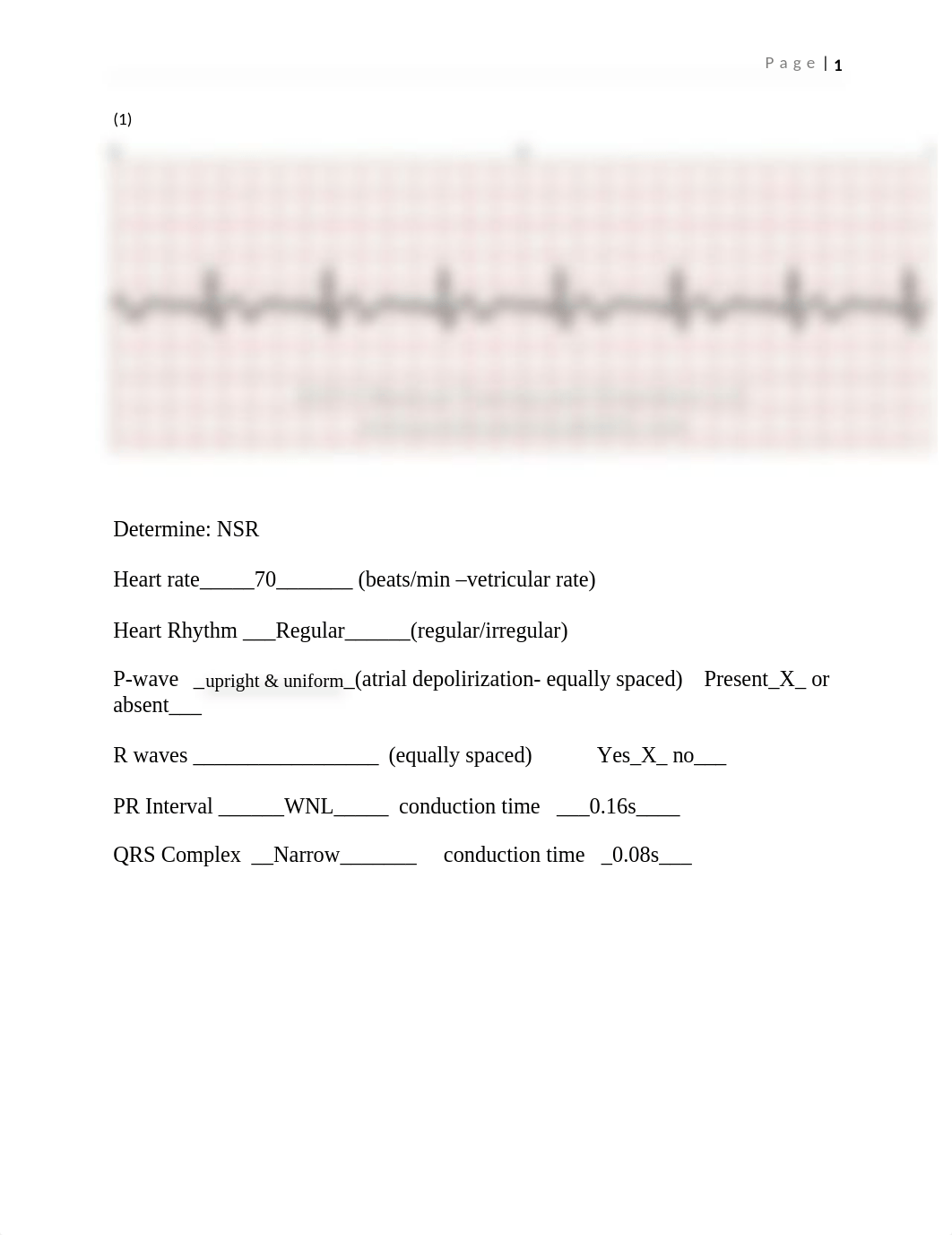 EKG Practice  RNSG 1240 2021.docx_dw6o0fu7337_page1