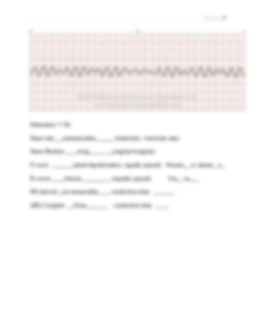 EKG Practice  RNSG 1240 2021.docx_dw6o0fu7337_page4