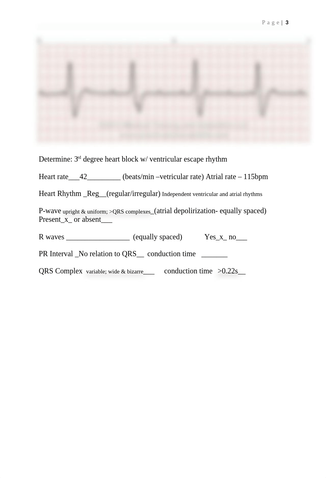 EKG Practice  RNSG 1240 2021.docx_dw6o0fu7337_page3