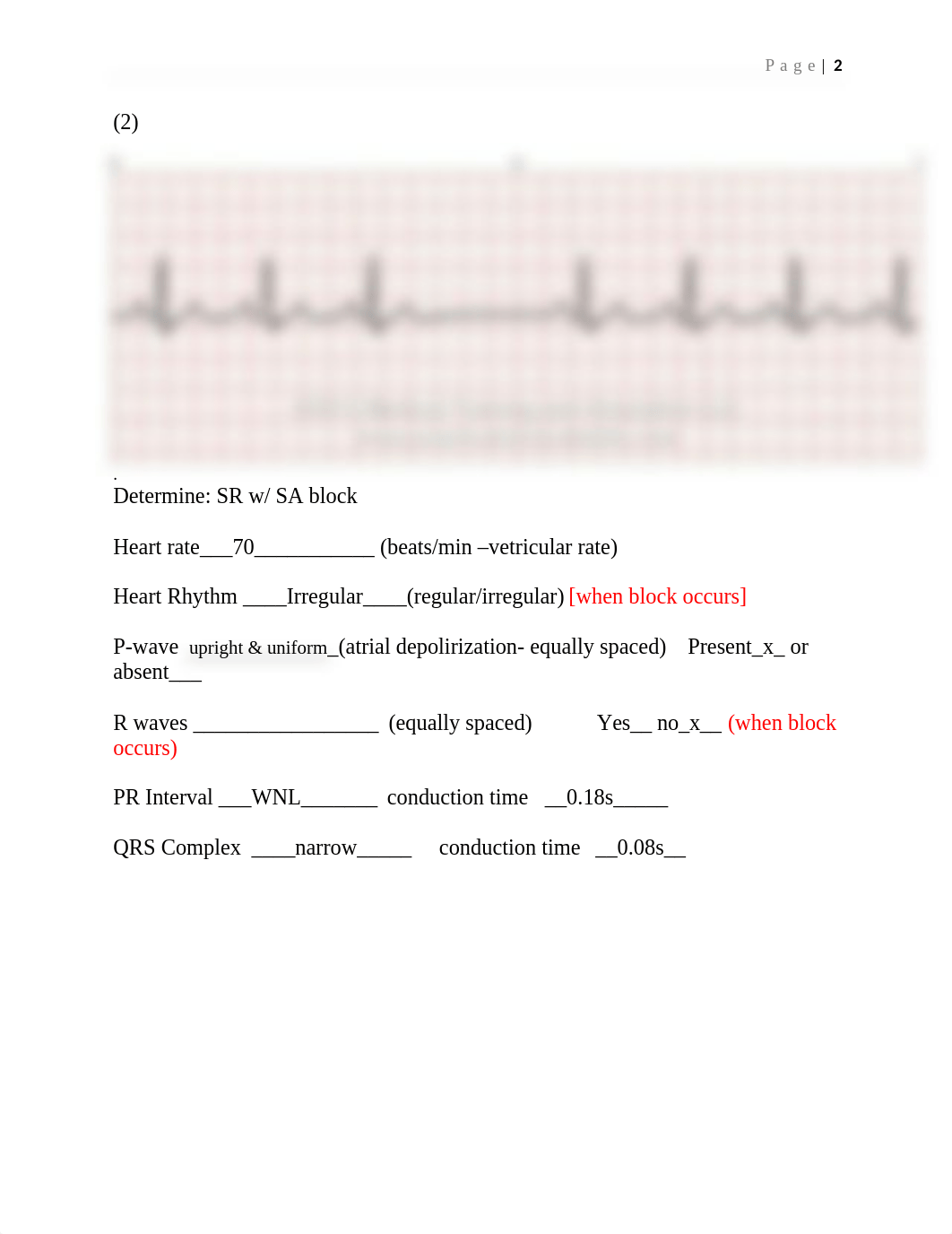 EKG Practice  RNSG 1240 2021.docx_dw6o0fu7337_page2